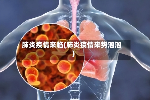 肺炎疫情来临(肺炎疫情来势汹汹)-第2张图片