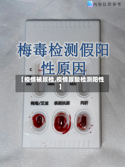 【疫情被尿检,疫情尿酸检测阳性】