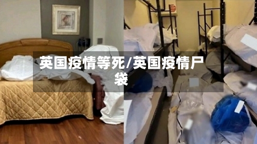 英国疫情等死/英国疫情尸袋-第2张图片