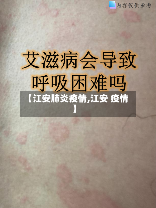 【江安肺炎疫情,江安 疫情】